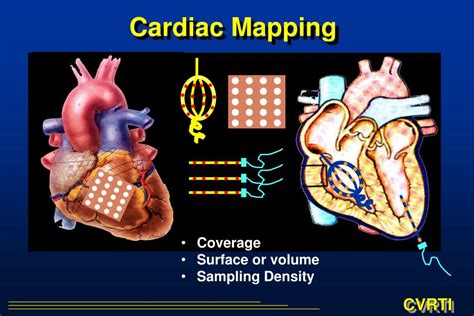 Fundamentals of Cardiac Mapping .